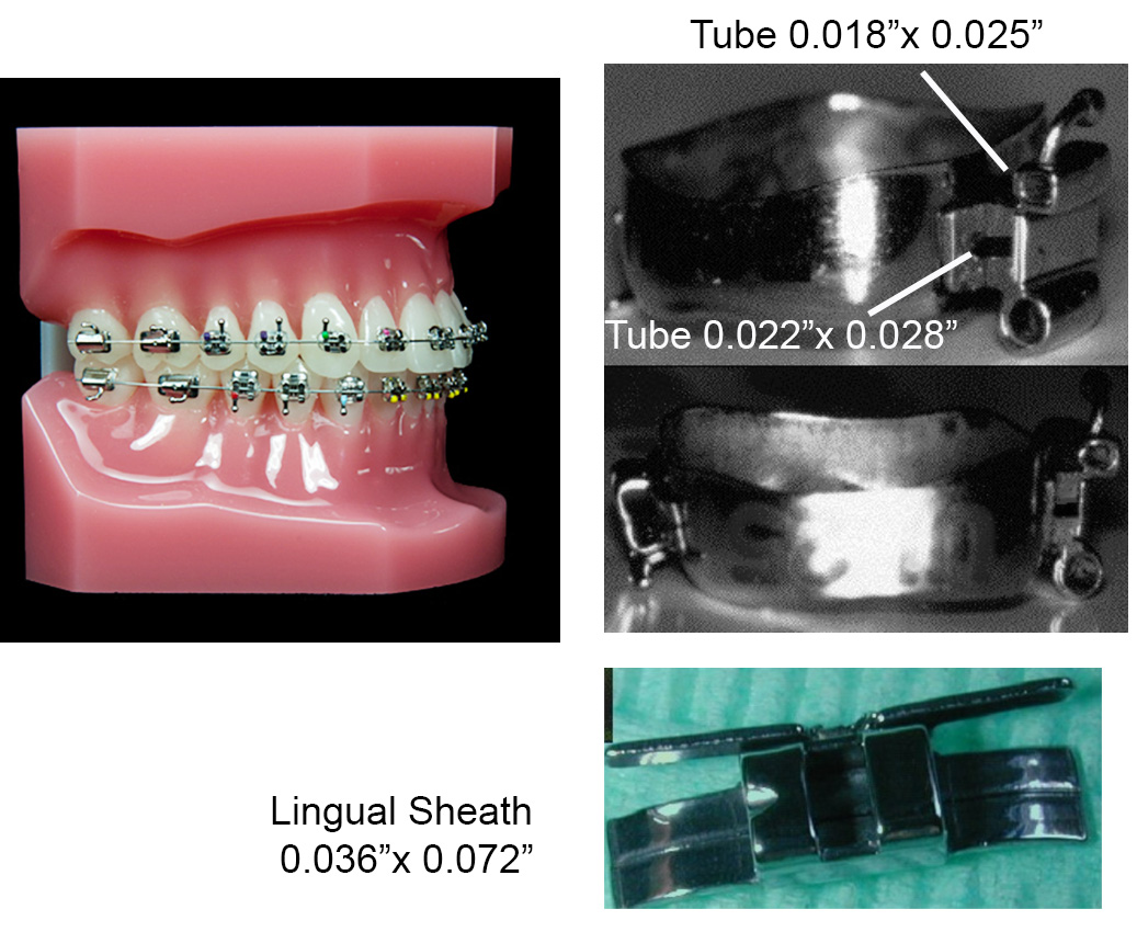 Demonstrative orthodontic typodont model